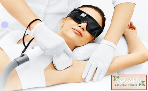 1 Процедура Диодна Лазерна Епилация на Интим + Подмишници за Жени от Savana Esthetic Center, Борово