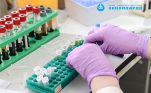 Пакет Профилактика Пълна Кръвна Картина и Биохимични Показатели от Лаборатории Кандиларов